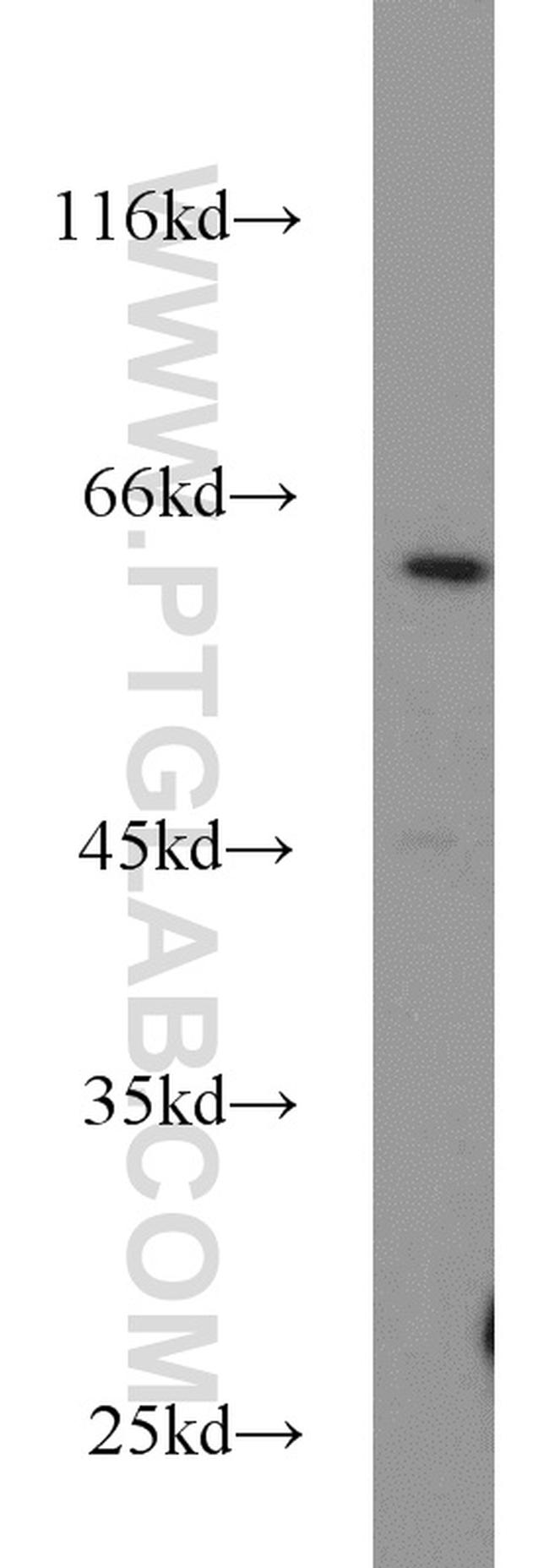 DNAJC11 Antibody in Western Blot (WB)