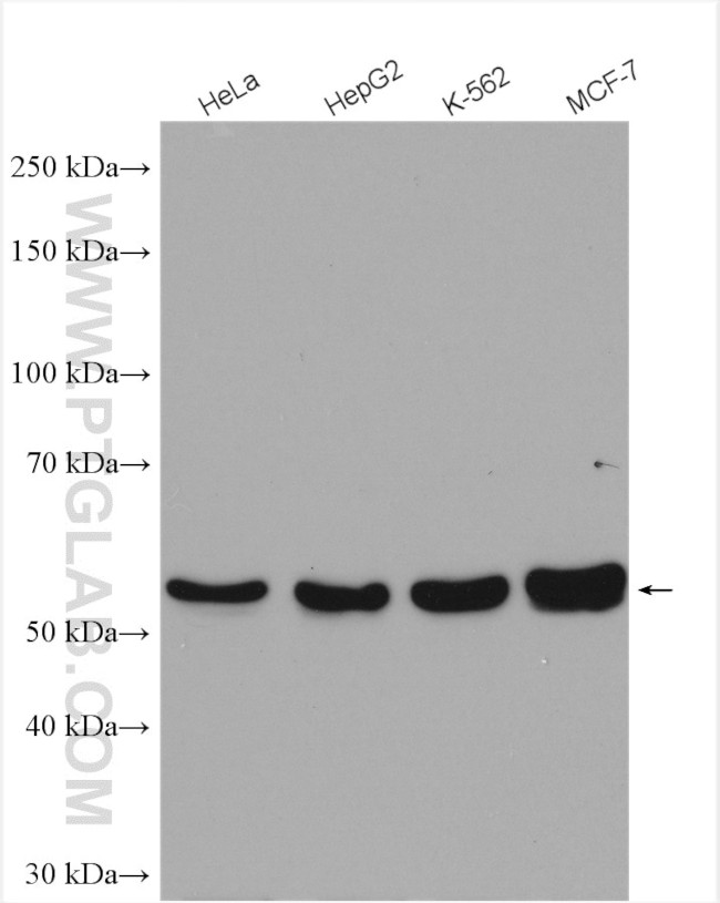 TADA2B Antibody in Western Blot (WB)