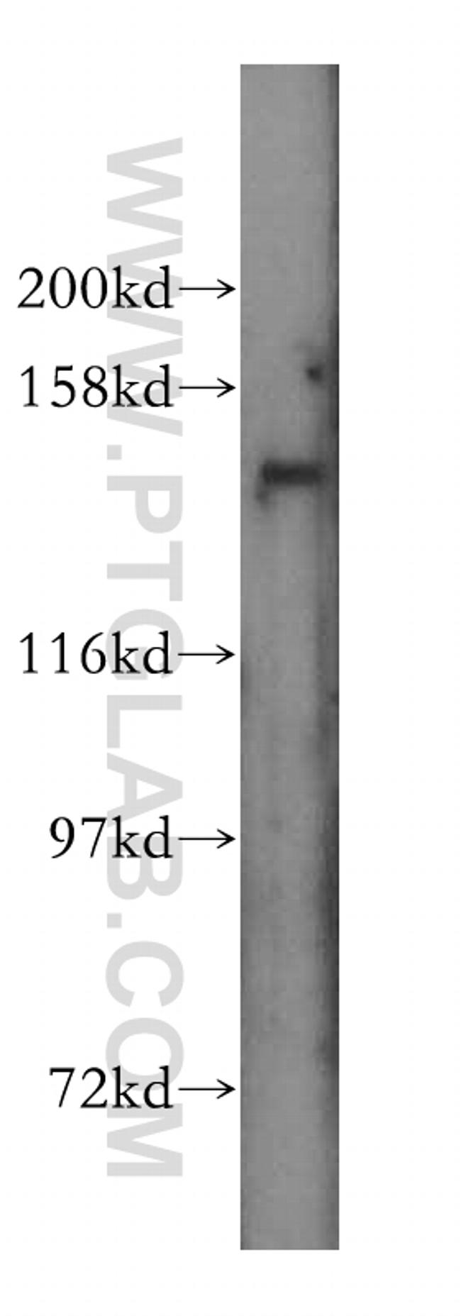 SLC9A11 Antibody in Western Blot (WB)