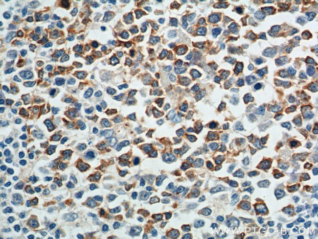 CXCL12/SDF-1 Antibody in Immunohistochemistry (Paraffin) (IHC (P))