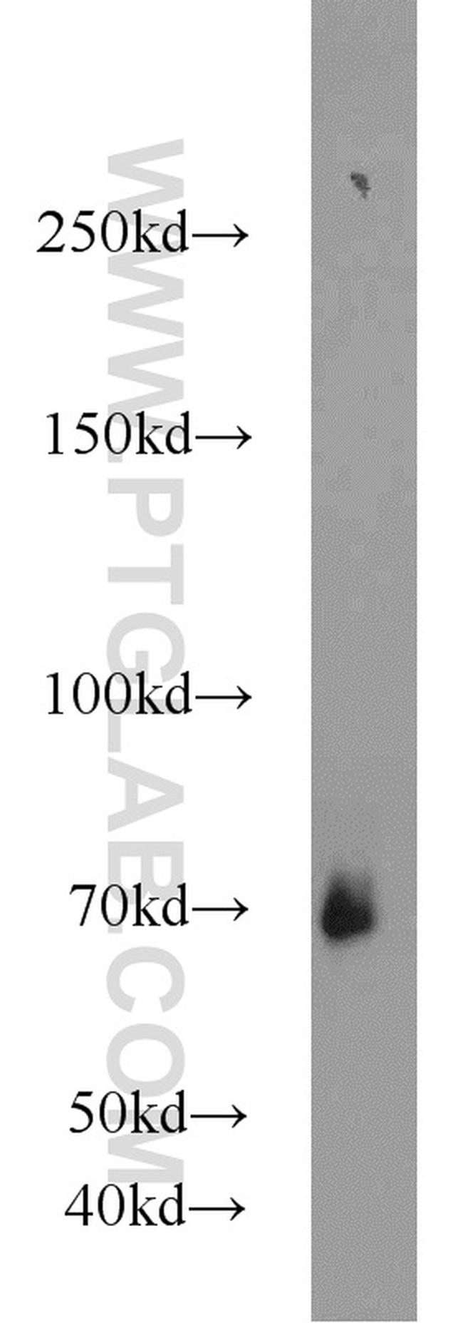 CSGALNACT2 Antibody in Western Blot (WB)