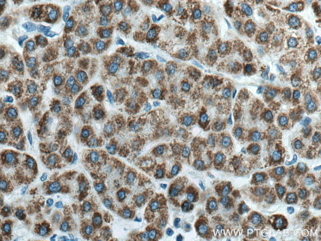 ACADL Antibody in Immunohistochemistry (Paraffin) (IHC (P))