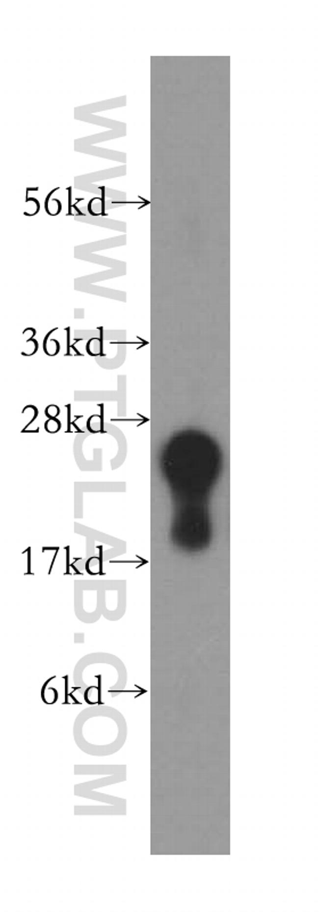 DTD1 Antibody in Western Blot (WB)