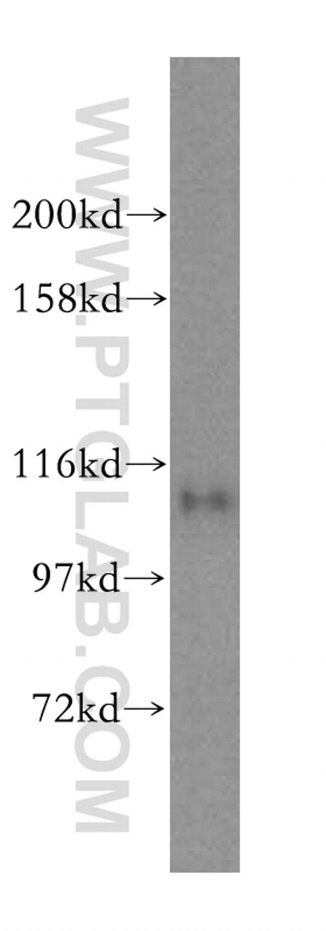 USP20 Antibody in Western Blot (WB)