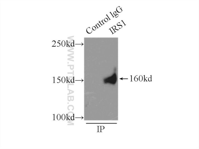 IRS1 Antibody in Immunoprecipitation (IP)