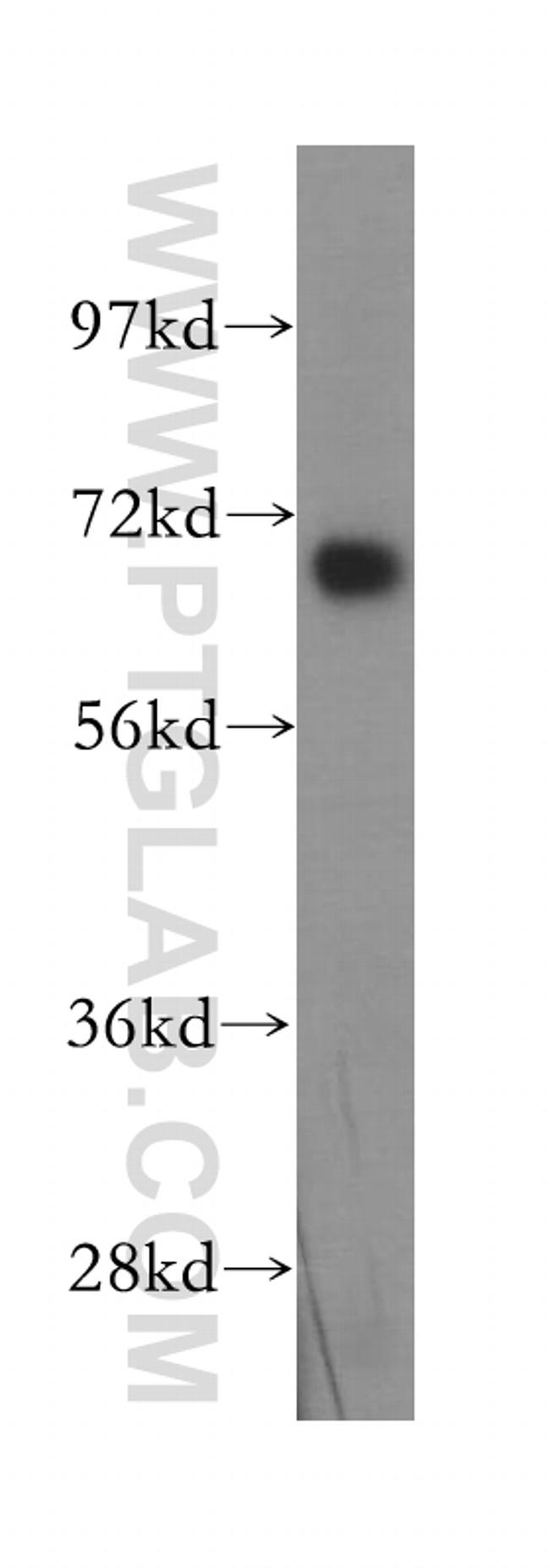 DNAI2 Antibody in Western Blot (WB)