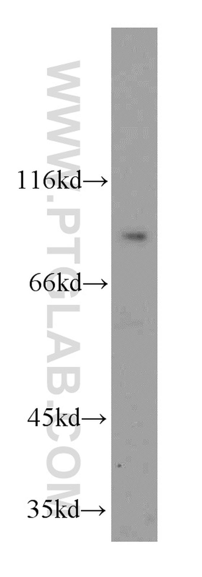 SMYD4 Antibody in Western Blot (WB)