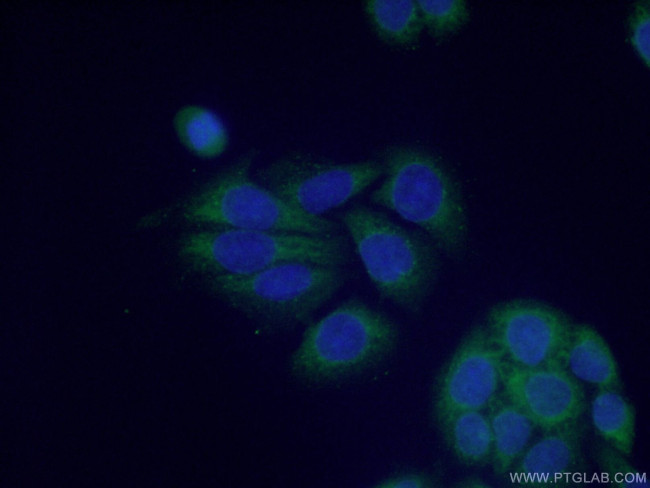 PRMT3 Antibody in Immunocytochemistry (ICC/IF)
