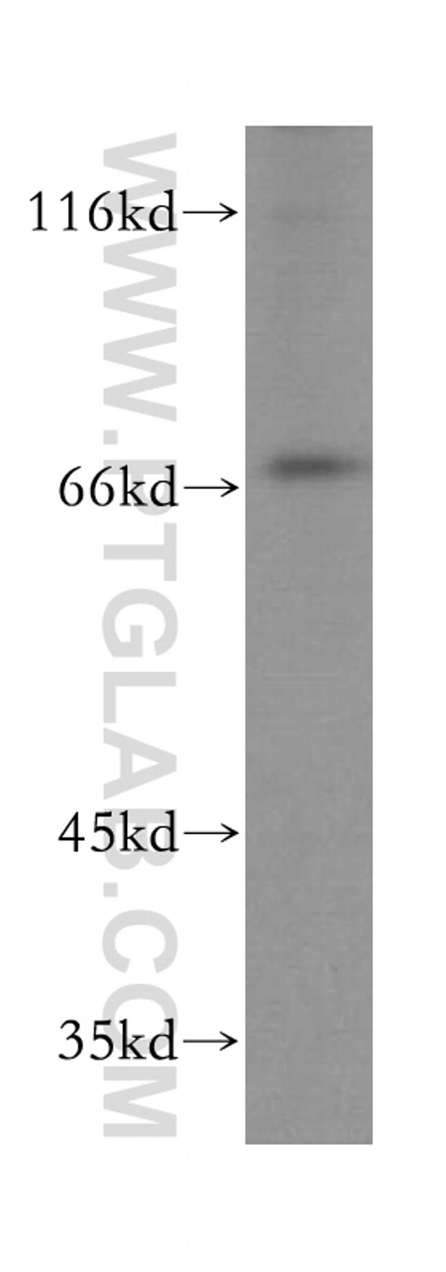 KLC2 Antibody in Western Blot (WB)