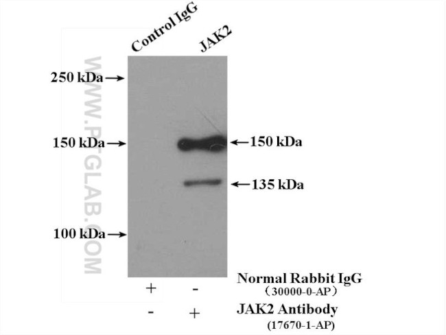 JAK2 Antibody in Immunoprecipitation (IP)