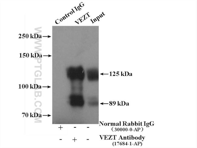 VEZT Antibody in Immunoprecipitation (IP)