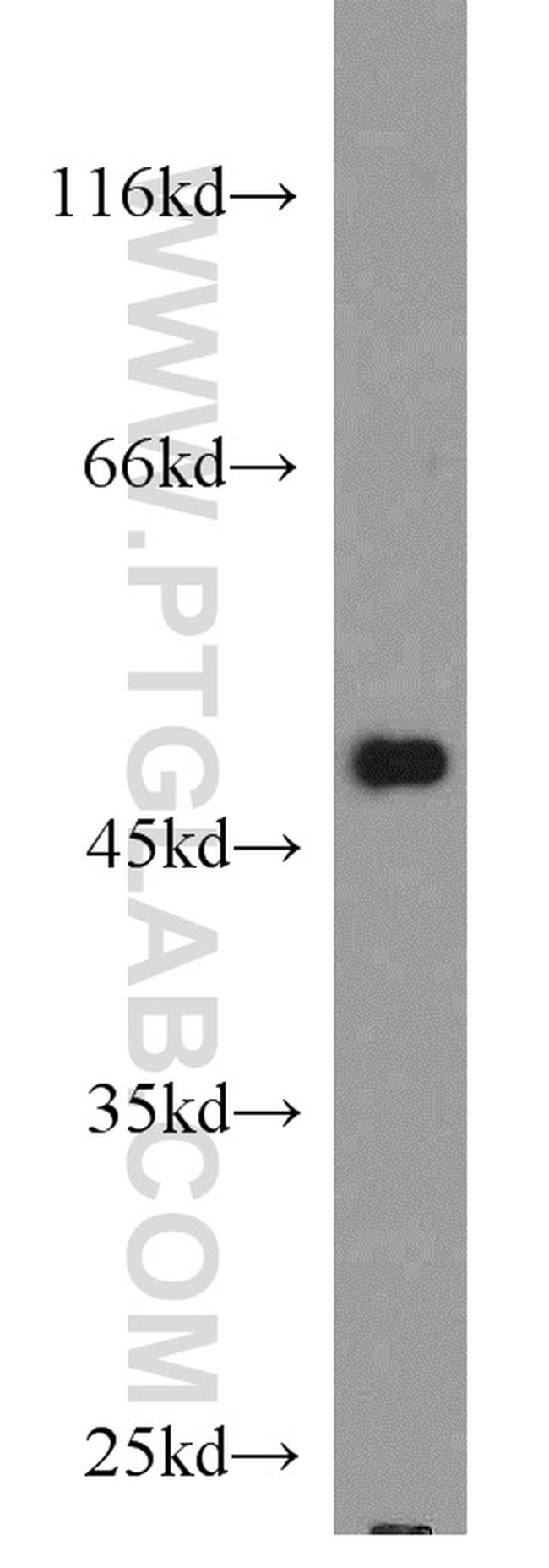 CSK Antibody in Western Blot (WB)