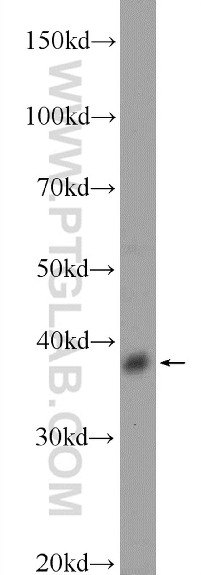 DSN1 Antibody in Western Blot (WB)