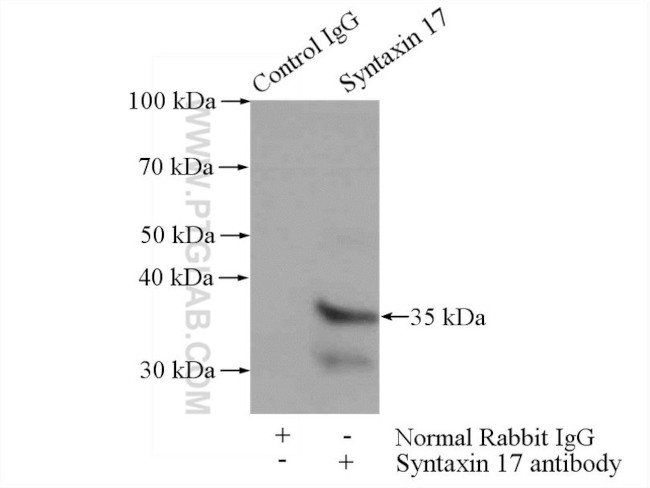 Syntaxin 17 Antibody in Immunoprecipitation (IP)