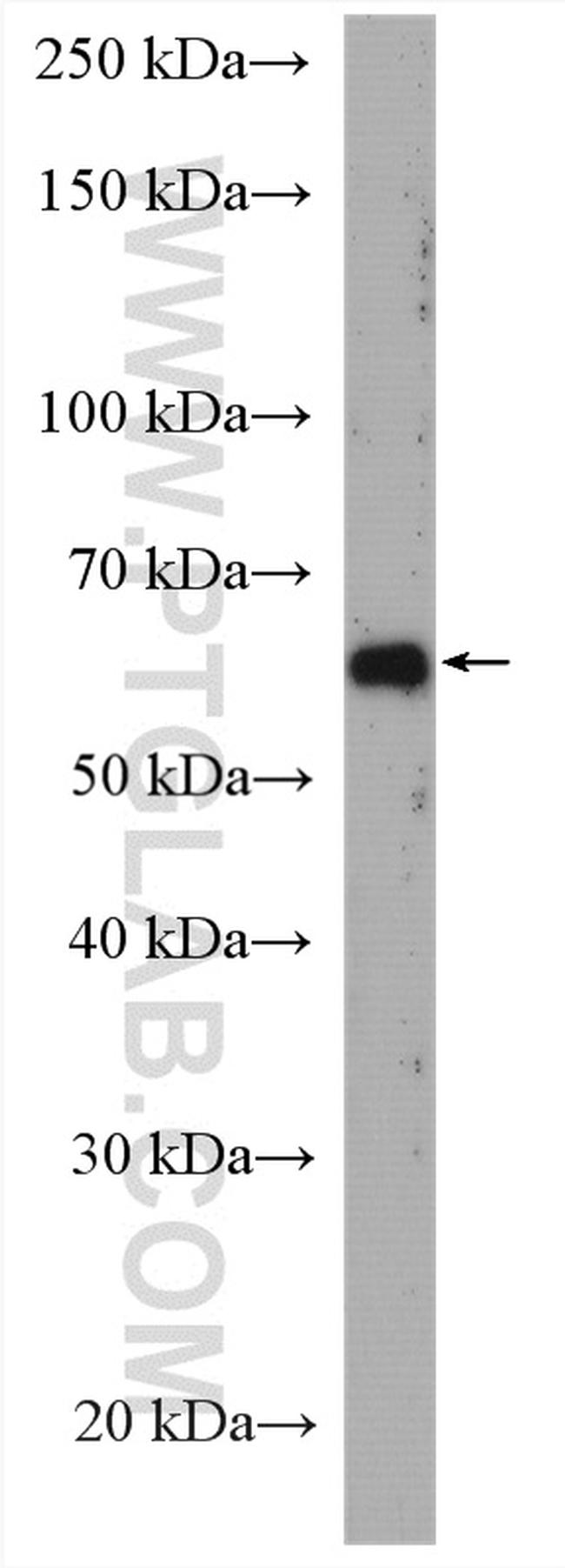 USP21 Antibody in Western Blot (WB)