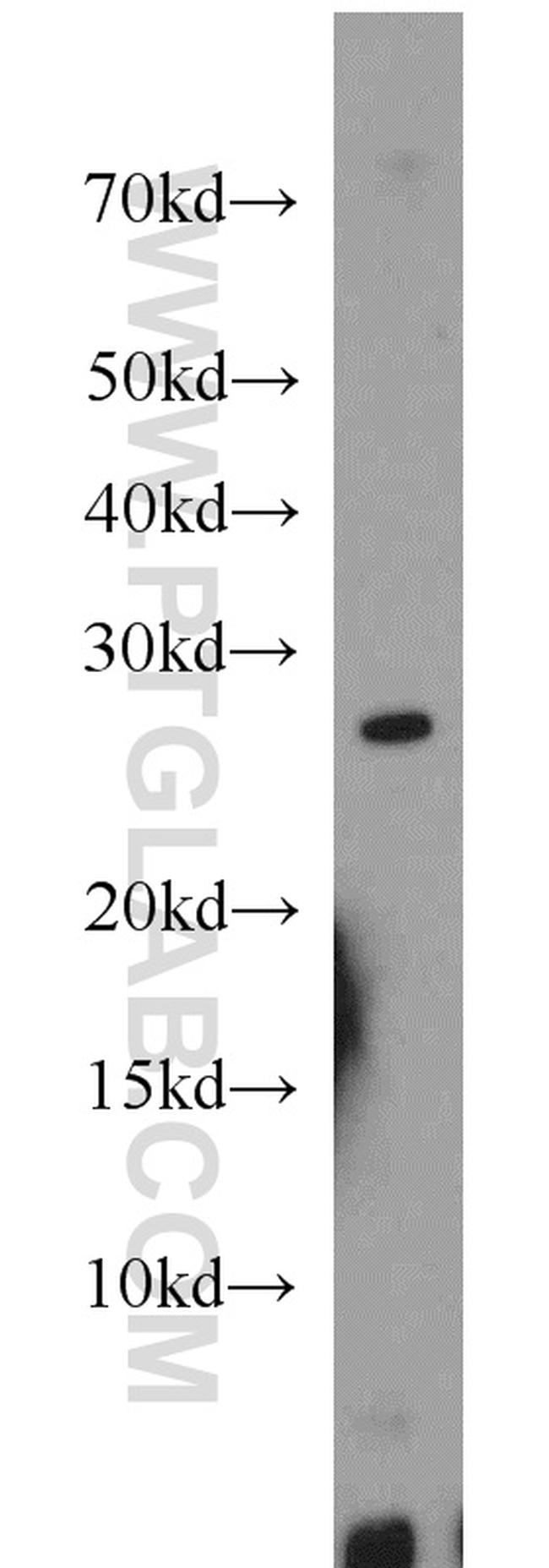 MXD1 Antibody in Western Blot (WB)