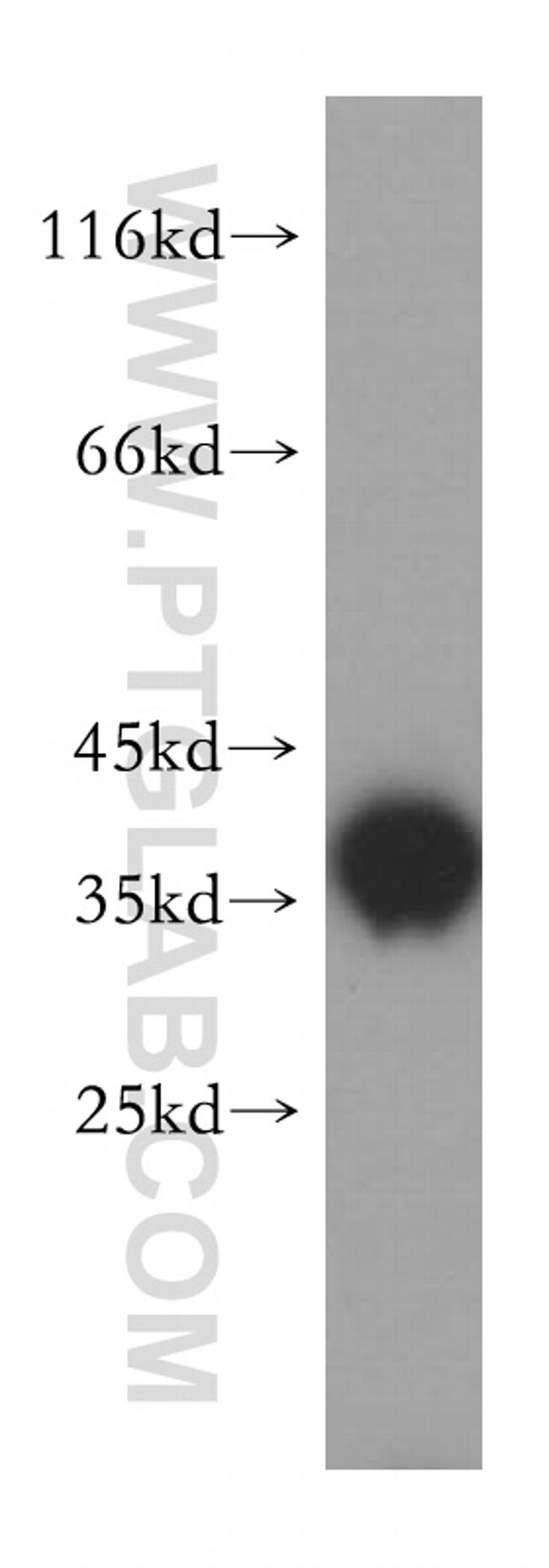 KCNAB2 Antibody in Western Blot (WB)