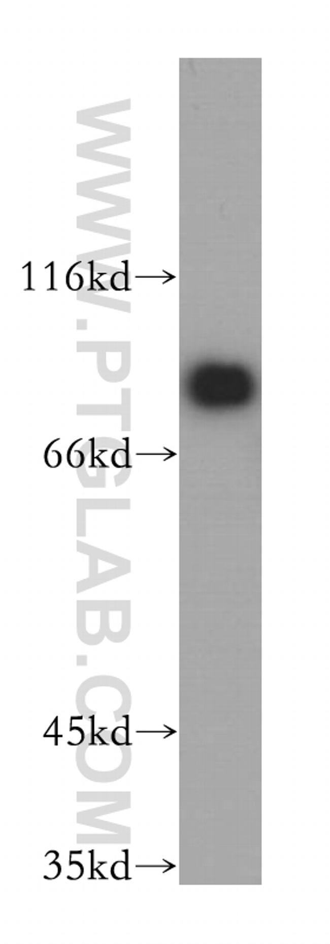 EIF4B Antibody in Western Blot (WB)