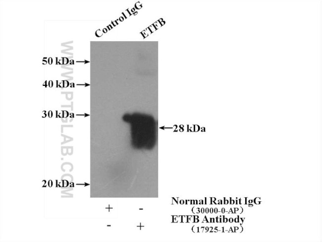 ETFB Antibody in Immunoprecipitation (IP)