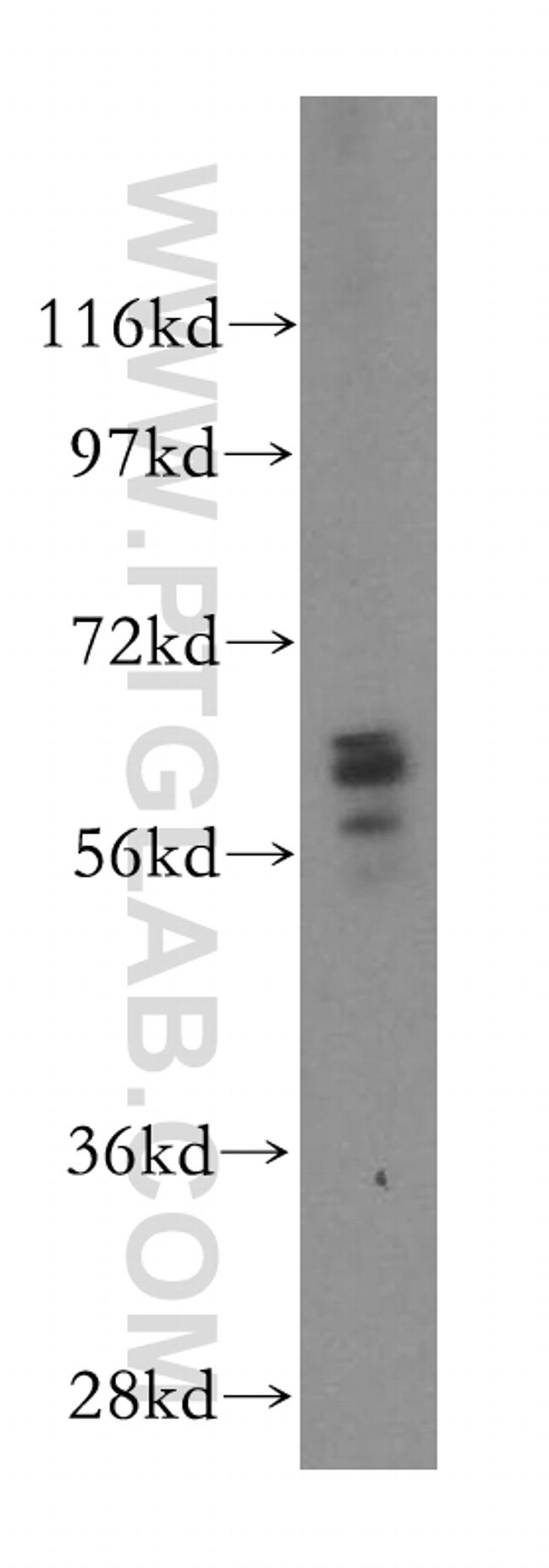 UGT8 Antibody in Western Blot (WB)