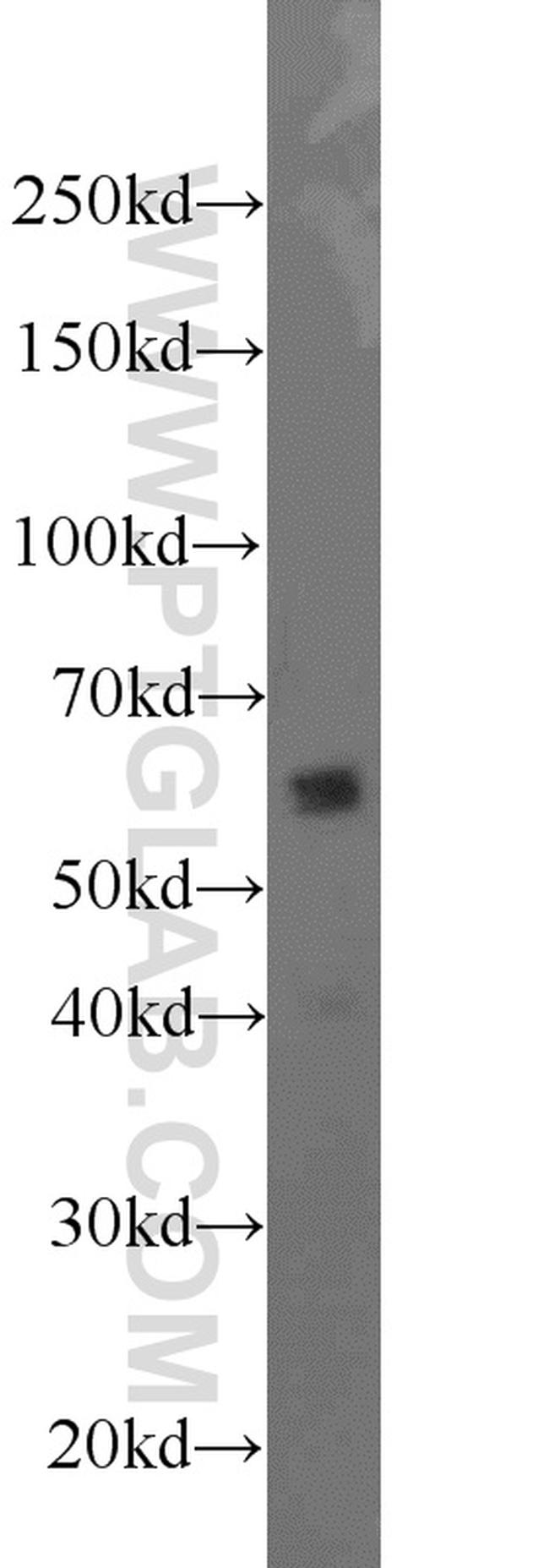 UGT8 Antibody in Western Blot (WB)