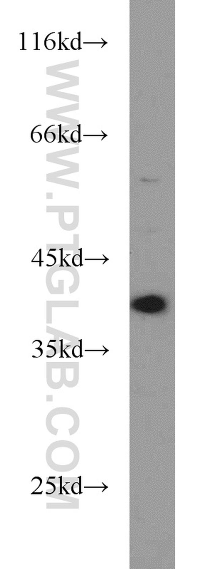 DNA polymerase beta Antibody in Western Blot (WB)