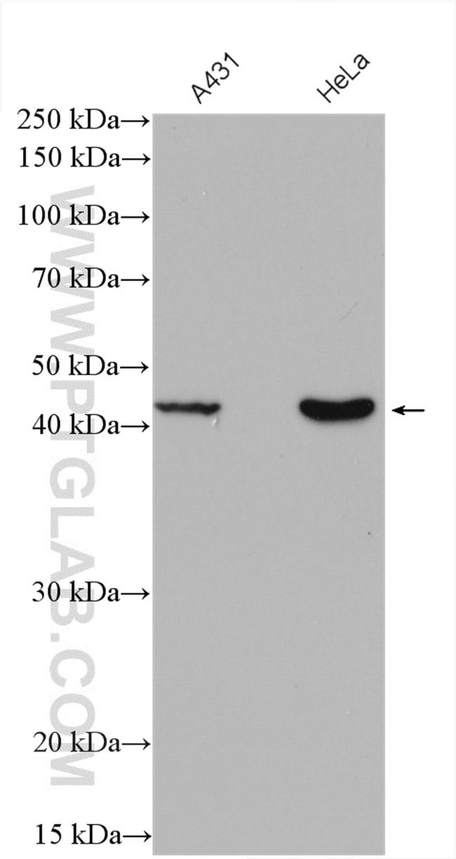 RRM2B/p53R2 Antibody in Western Blot (WB)