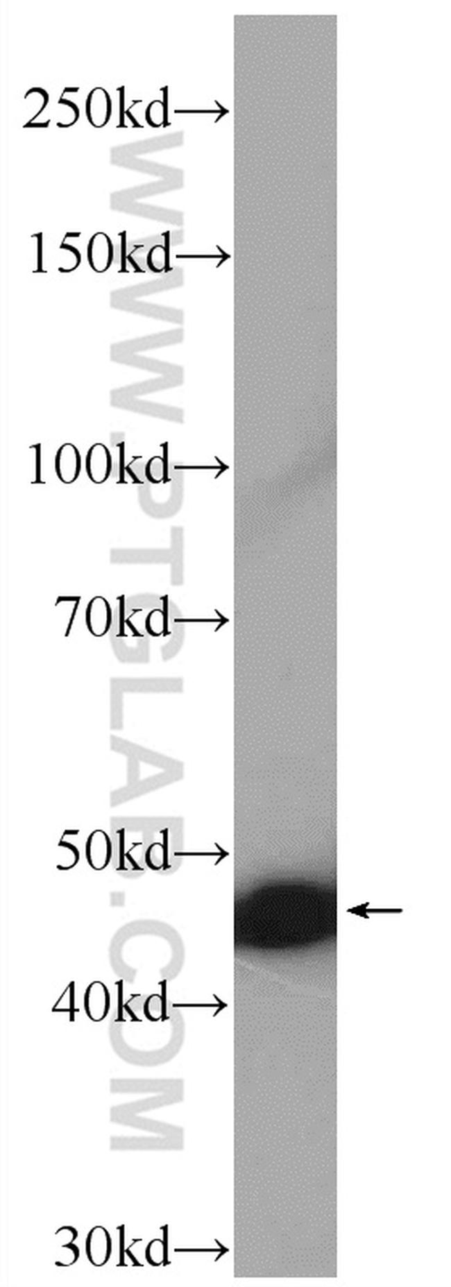 Interferon alpha Antibody in Western Blot (WB)