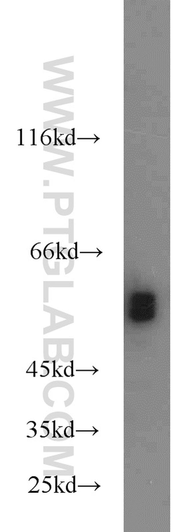 fetuin-B Antibody in Western Blot (WB)