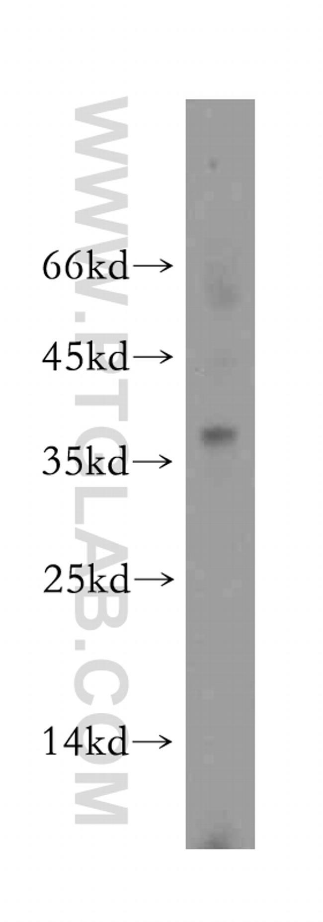 PGLYRP3 Antibody in Western Blot (WB)