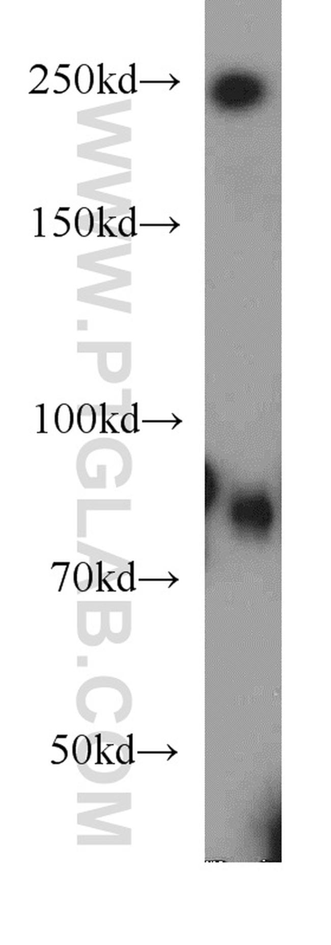 TEM1 Antibody in Western Blot (WB)