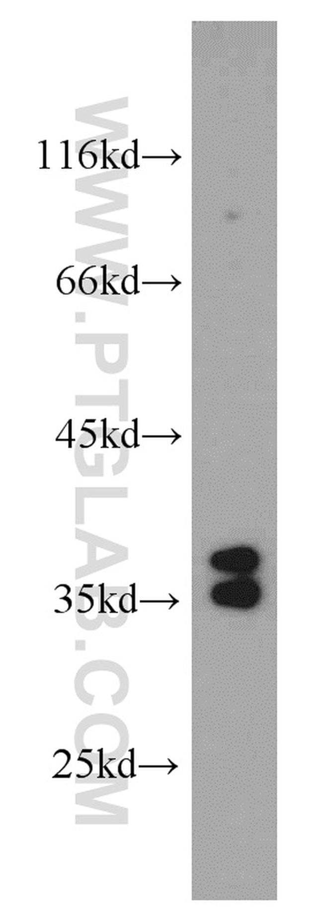 AIP/ARA9 Antibody in Western Blot (WB)