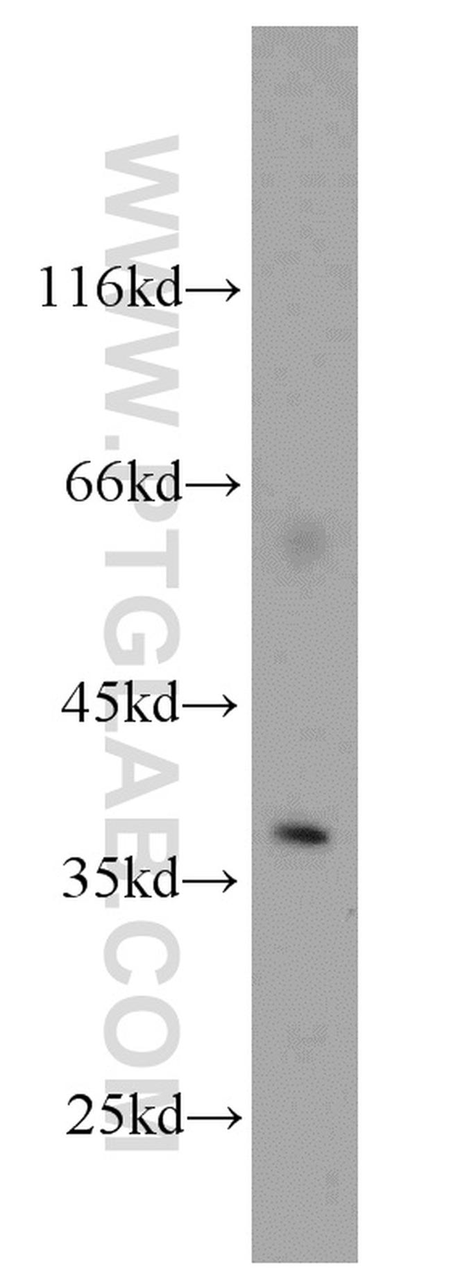 AIP/ARA9 Antibody in Western Blot (WB)