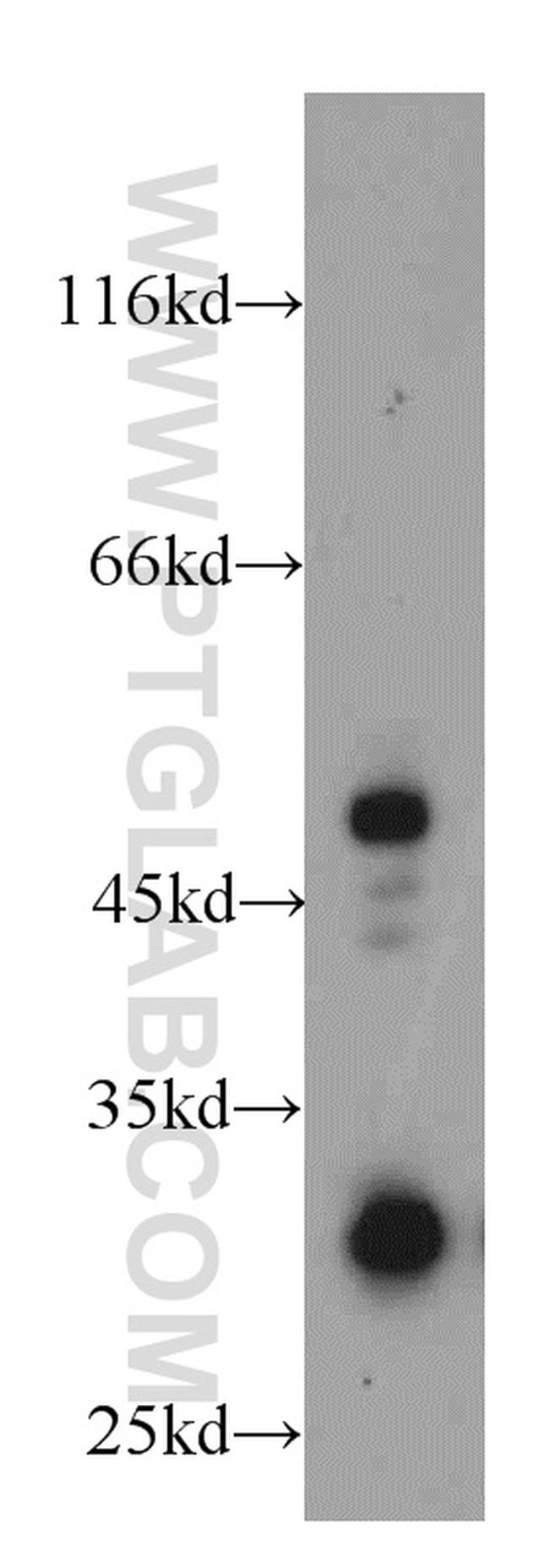 HUS1B Antibody in Western Blot (WB)