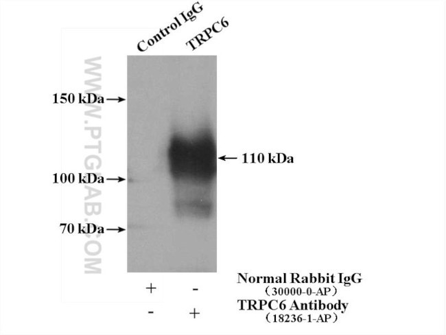 TRPC6 Antibody in Immunoprecipitation (IP)