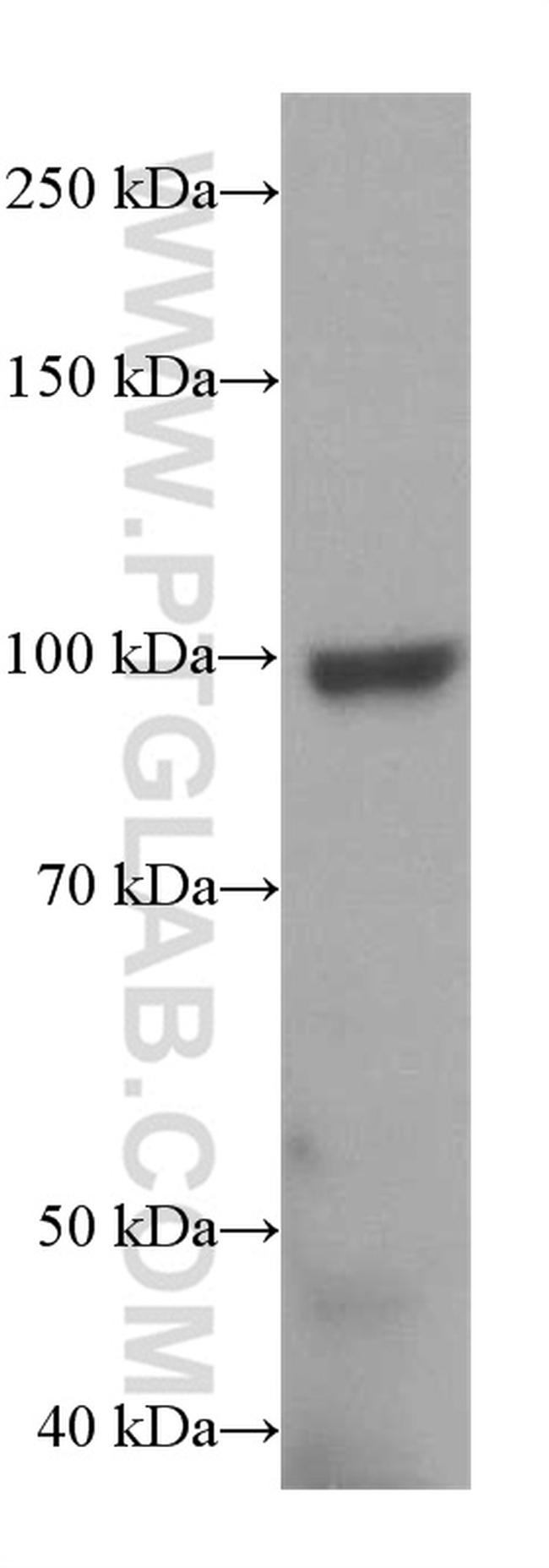 TRPC6 Antibody in Western Blot (WB)