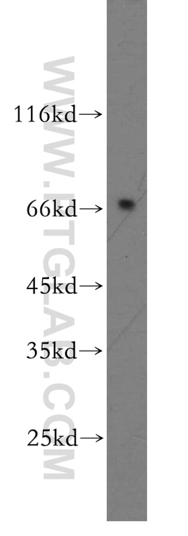 MMP28 Antibody in Western Blot (WB)