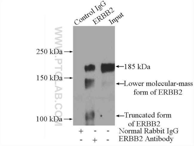 HER2/ErbB2 Antibody in Immunoprecipitation (IP)