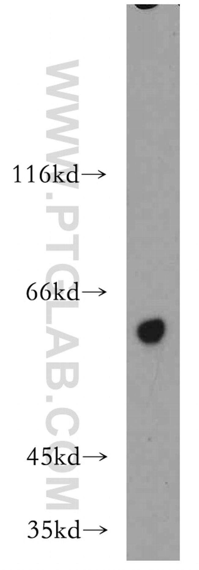 TBC1D22A Antibody in Western Blot (WB)