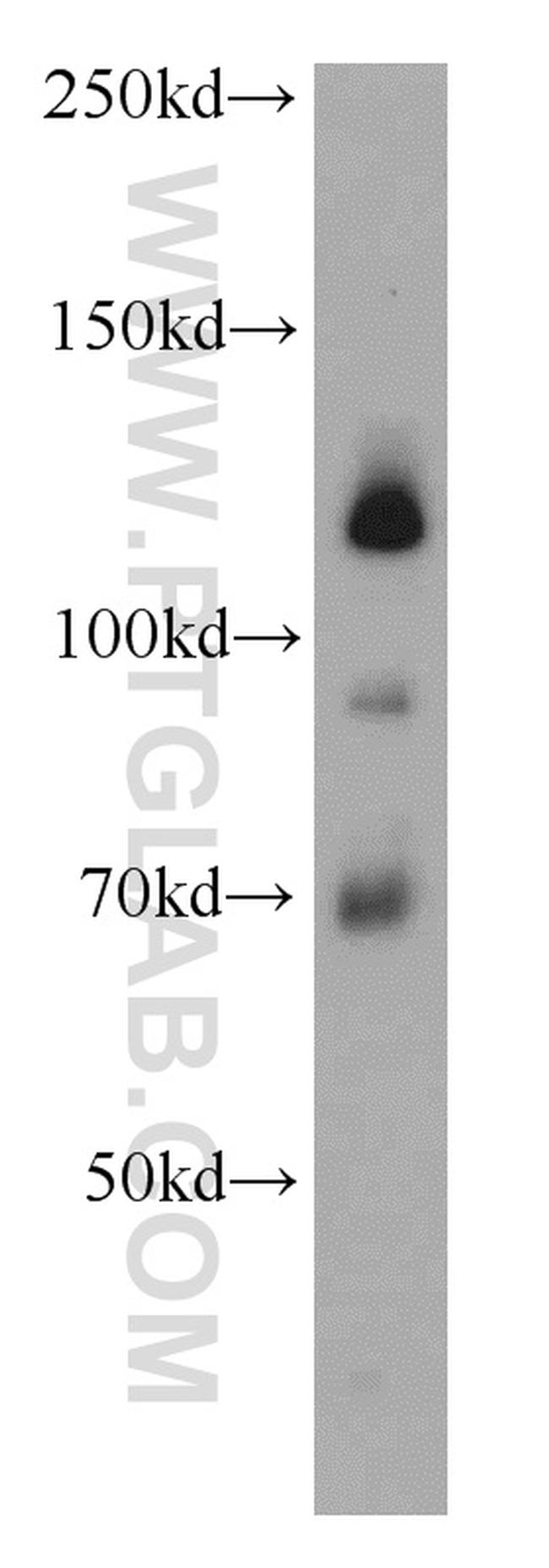 USP37 Antibody in Western Blot (WB)