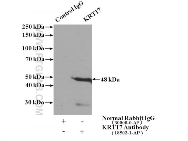 Cytokeratin 17 Antibody in Immunoprecipitation (IP)