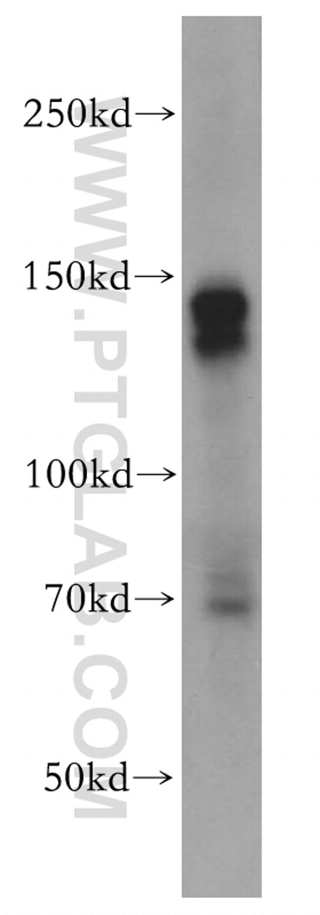 c-Kit/CD117 Antibody in Western Blot (WB)