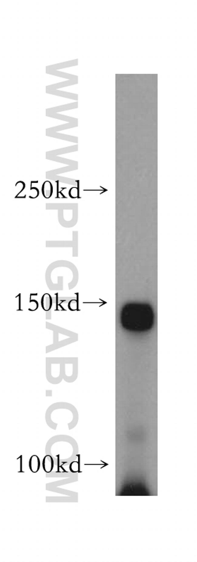 EPHA1 Antibody in Western Blot (WB)