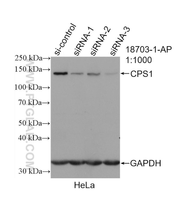 CPS1 Antibody in Western Blot (WB)