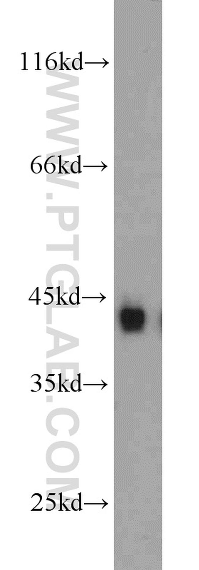 CKM Antibody in Western Blot (WB)