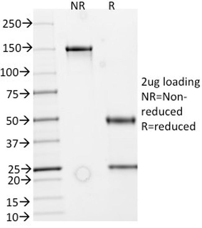 Secretory Component/ECM1 Antibody in SDS-PAGE (SDS-PAGE)