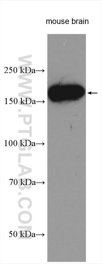 GLI2 Antibody in Western Blot (WB)