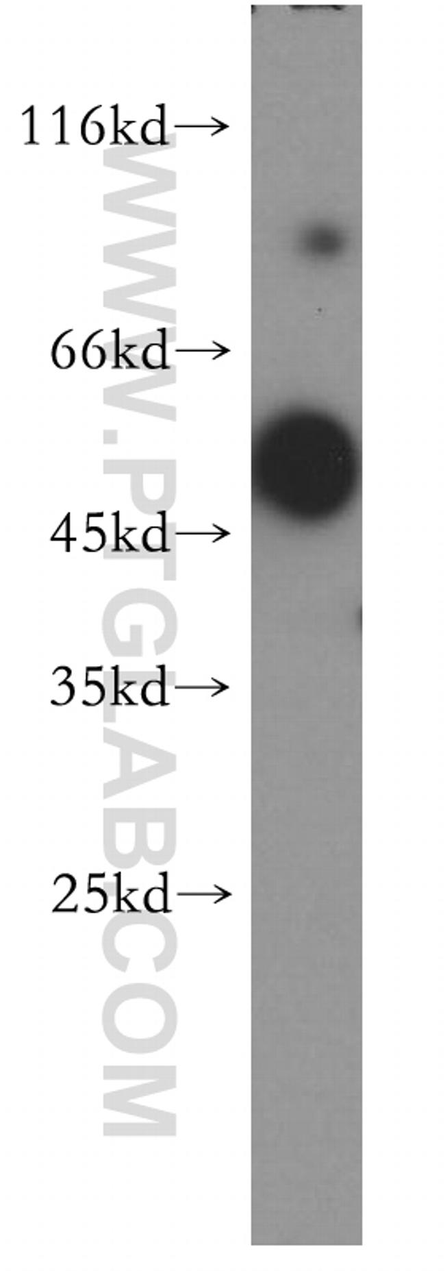 BRUNOL6 Antibody in Western Blot (WB)