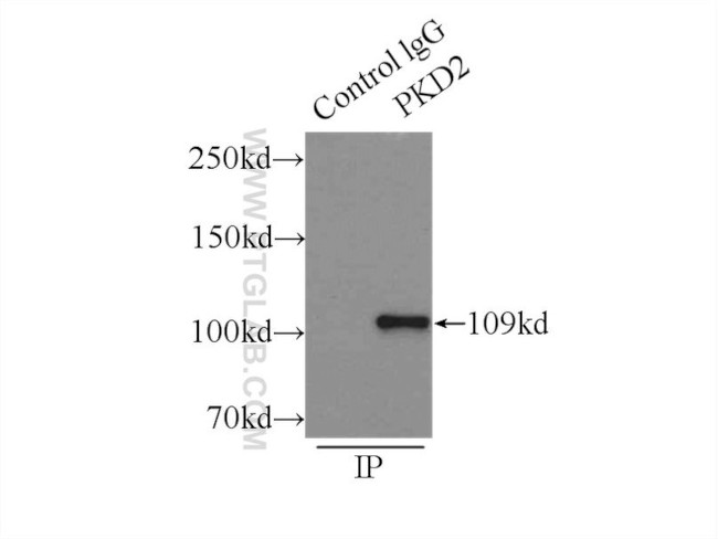 Polycystin 2 Antibody in Immunoprecipitation (IP)