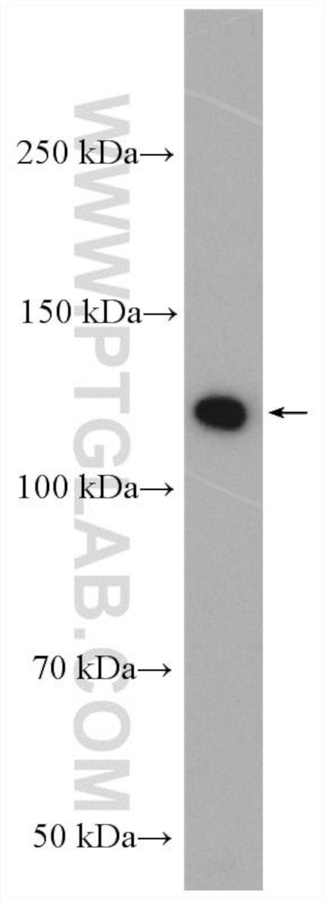 PARK9/ATP13A2 Antibody in Western Blot (WB)